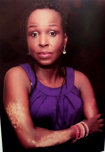 Against all odds, I survived scleroderma —Elizabeth Onuoha-Ozumba 