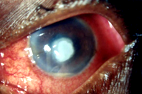 Doctors Predicted I Would Never Cure My Glaucoma & Cataract… But Contrary To Their Prediction, I Cured It Permanently and Naturally In Just 2 Months! I’ll Show You How