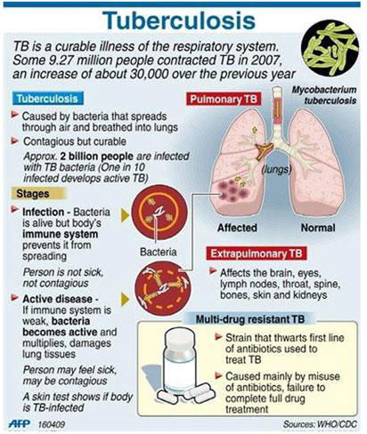 FG, USAID sign agreement to accelerate TB response