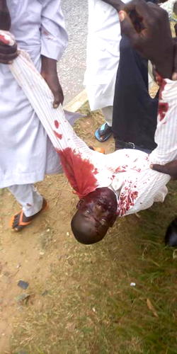 Photos: Many injured as Shiites defy army