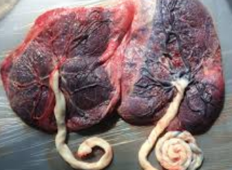 Muslim cleric, nurse nabbed over missing placenta
