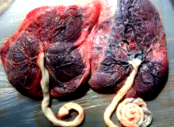 Muslim cleric, nurse nabbed over missing placenta