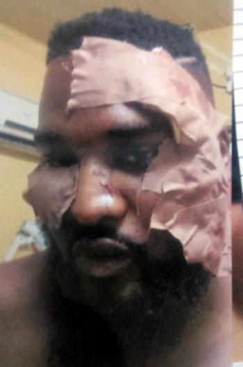 2 men arraigned for stabbing Wizkid’s bodyguard