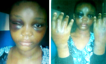 Man docked for hitting 12 years old daughter’s eyes with knife