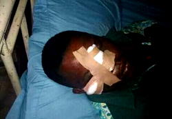 Man risks losing eye for querying thugs destruction of campaign billboards
