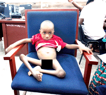 Boy, 3, seeks N1.3m for corrective limb surgery