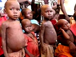 Malnutrition kills 132 children in Kaduna state — Official