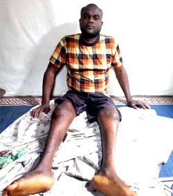 “Please help, don’t let me die,”cries 30-yr old man, crippled by hit-and-run driver