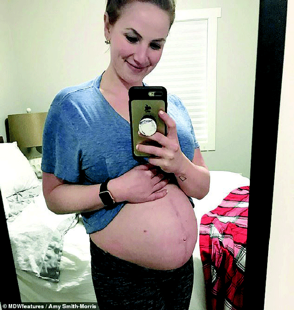 Cancer survivor who had an ovary removed defies the odds to give birth to a healthy boy