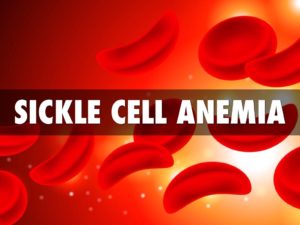 Sickel cell