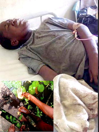 I did not steal from any pond,  12-yr-old whose hand was cut off cries out