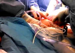 Expert advises pregnant women on CS
