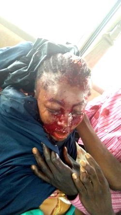 How DCP, 7 others died as Shi’ites protest turns bloody in Abuja