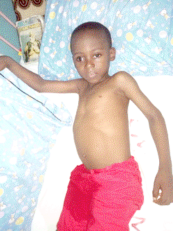 Boy, 6, loses eye to leukemia, needs N25m for surgery