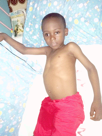 Boy, 6, loses eye to leukemia, needs N25m for surgery
