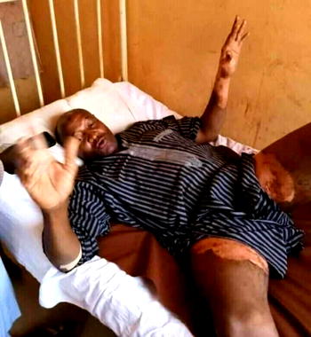 Wife pours hot water on husband’s private parts for planning to take another wife