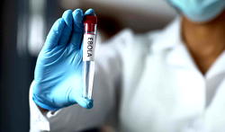 DR Congo starts countdown to end of Ebola outbreak in east