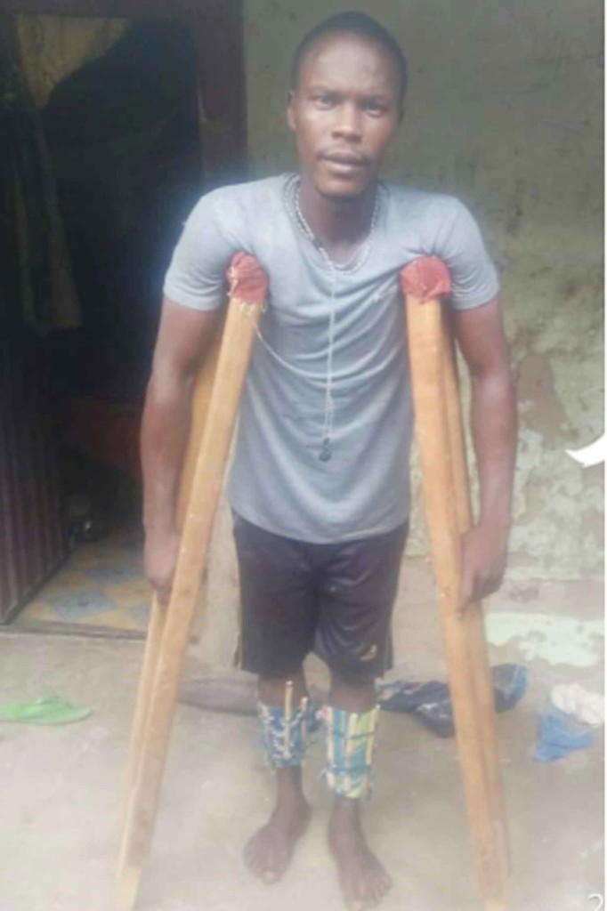 Bauchi police invites torture victim for 'interview' after... - Vanguard News - Vanguard