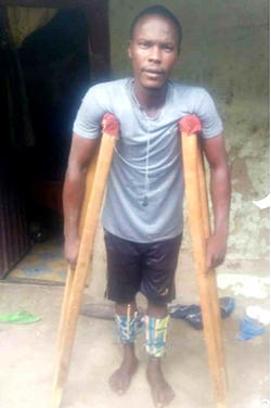 Bauchi police invites torture victim for ‘interview’ after Vanguard’s report