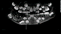 Forensic Odontology: How can your teeth help with investigation?
