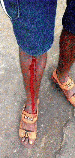 RevolutionNow protest: (Photos) One allegedly shot in the leg
