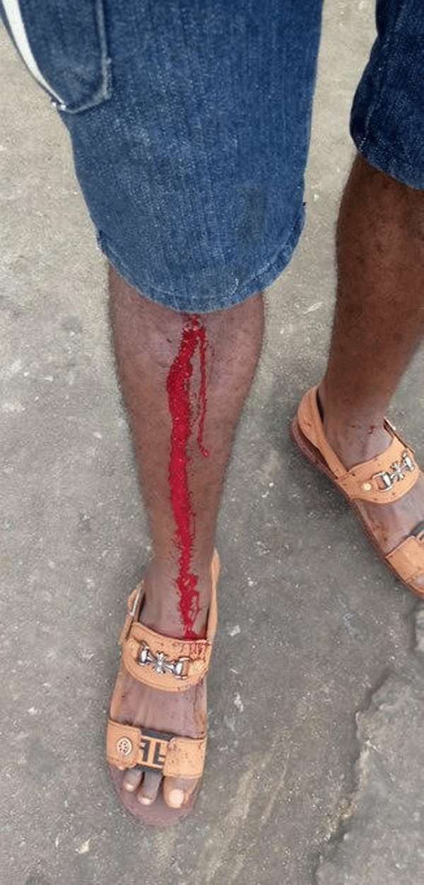 RevolutionNow protest: (Photos) One allegedly shot in the leg