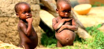 Malnutrition: If we don’t act fast these children will die — Caregivers cry out