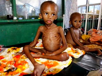 A Child’s Cry: Nigeria’s malnutrition crisis demands urgent action