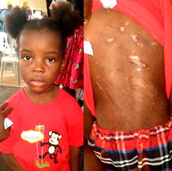 Police hunt for father who beat 4-yr-old ‘witch kid’ to death
