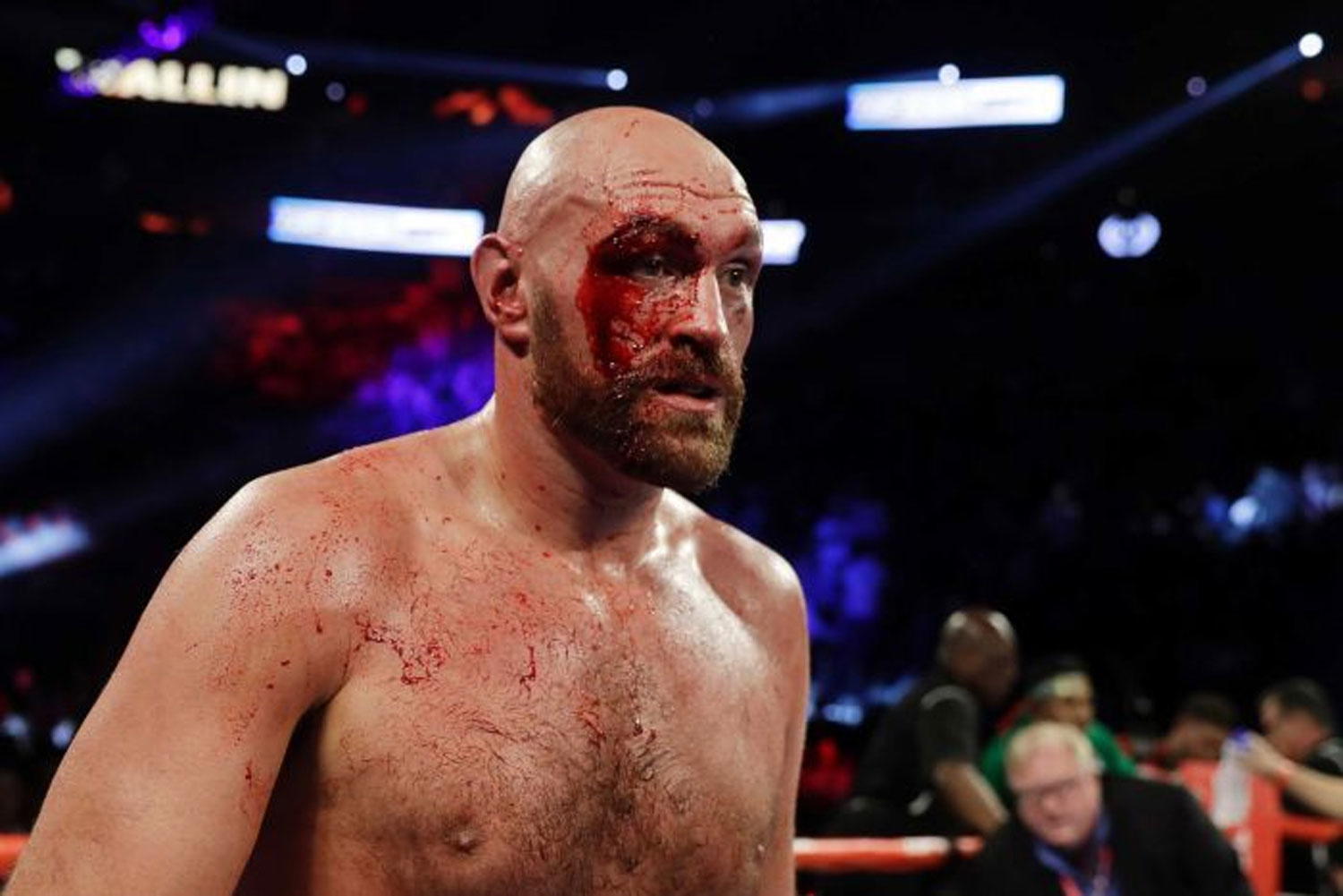 Tyson Fury