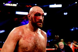 Bloodied Fury survives severe cut to outpoint Sweden’s Wallin