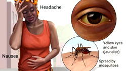 Yellow fever: Gombe confirms three cases, says source traced to Yankari in Bauchi