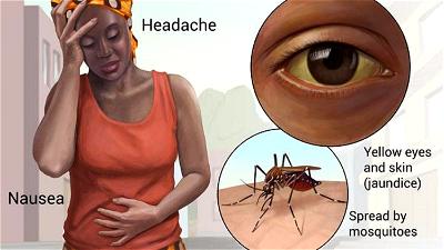 Katsina Govt to immunise 7m residents against Yellow Fever