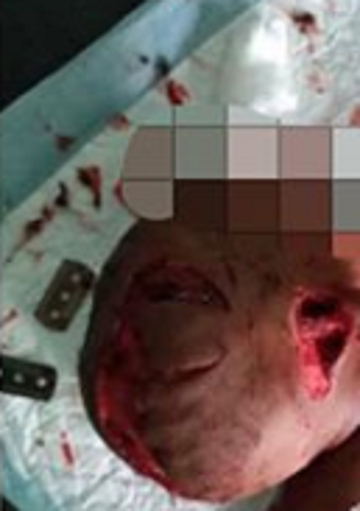 (Photos) Dog butchers 1-yr-old boy in Abuja