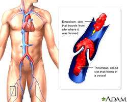 Lockdown: Exercise regularly to prevent thrombosis, Pharmacist advises Nigerians