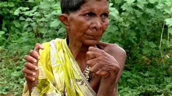 Woman born with 12 fingers, 20 toes tagged ‘witch’ by neighbours