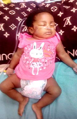 Ailing infant desperately needs N4m for corrective heart surgery
