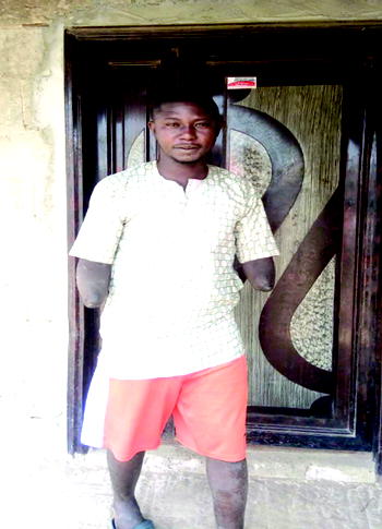 I’ll be showing ingratitude  to God by begging to survive, says double amputee 