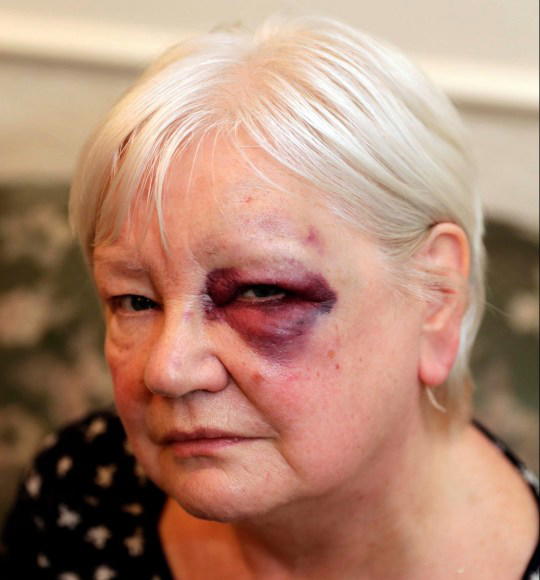 Pensioner attacked while handing out Christmas gifts to the homeless