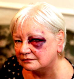 Pensioner attacked while handing out Christmas gifts to the homeless