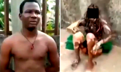 Girl set alight by boyfriend for allegedly cheating on him dies