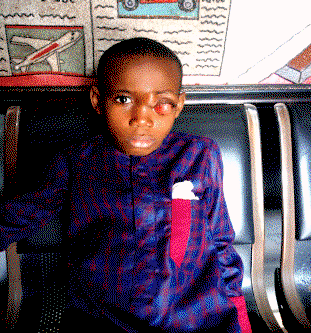 Daniel seeks N7m for eye cancer treatment