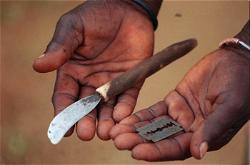Gynecologist wants gov’t to formulate laws to curb Female Genital Mutilation