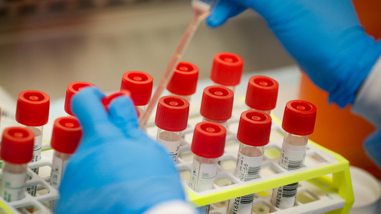 Contact Tracing: Osun sends 30 samples for test