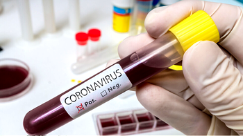Bulgaria coronavirus update: 1 death, 2 new cases, 94 infected persons