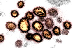 Viruses and civilisation