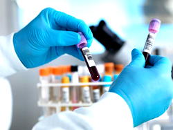 COVID-19: Scientists project 450,000 cases for Africa by May