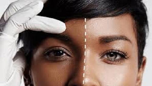 Stop bleaching or risk coronavirus disease – Medical expert