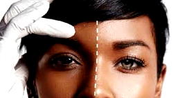 Stop bleaching or risk coronavirus disease – Medical expert