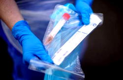 COVID-19: 22 of 25 suspected cases test negative in Kano